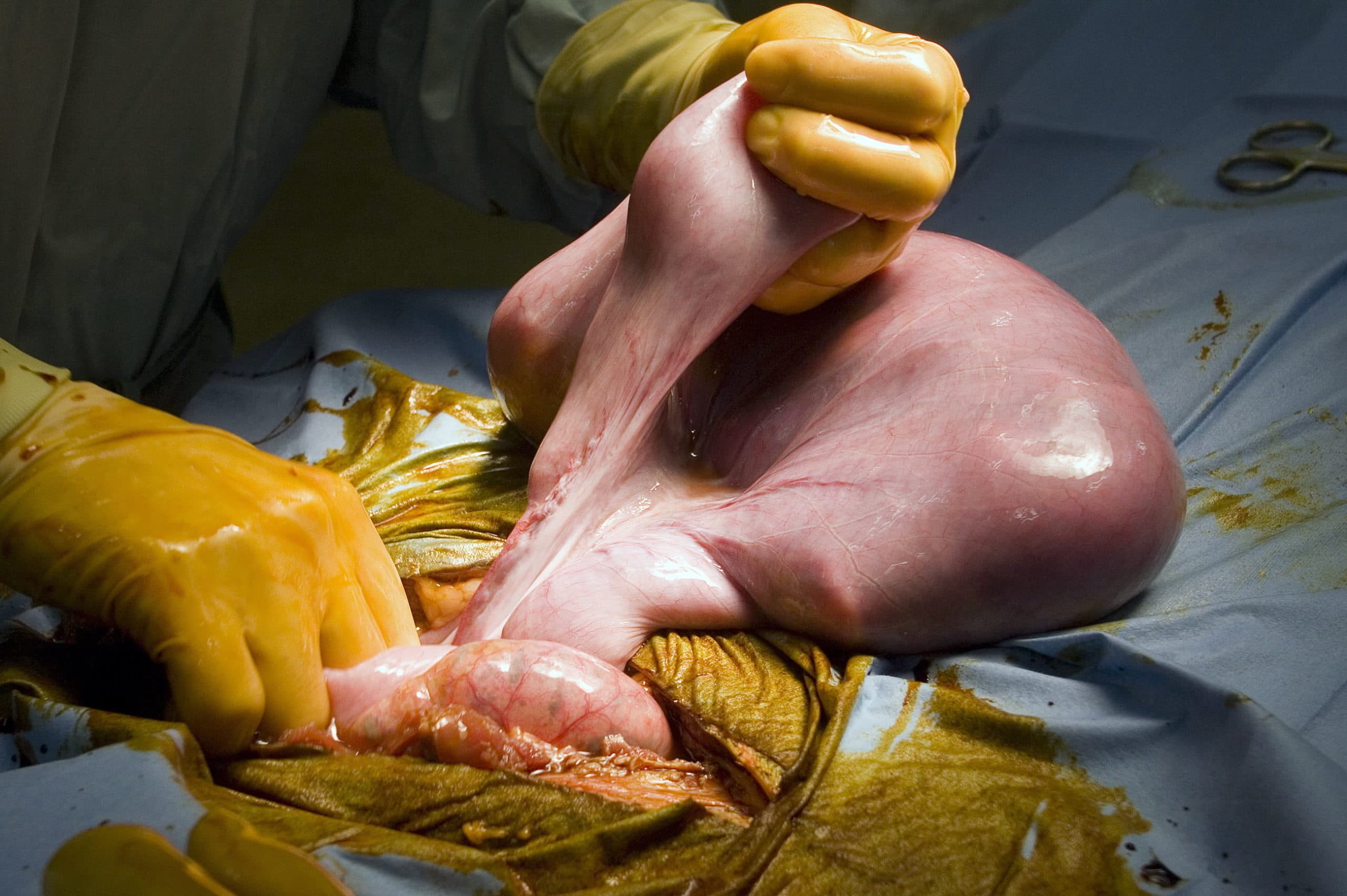 Als een keizersnede nodig is bij een zeug, is dat dier 'eigenlijk al in levensgevaar'. - Foto: Animal Sciences Group