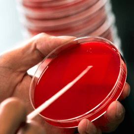 Toename in multiresistente bacteriën in Europa