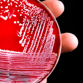 MRSA bij varkens in Verenigd Koninkrijk