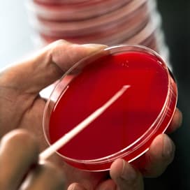 MRSA bij varkens op landbouwshows
