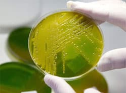 WHO: meer voedselinfecties door handel