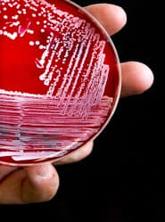 Aantal MRSA-infecties blijft vrijwel gelijk